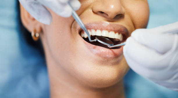 Best Emergency Broken Tooth Repair in Emma, NC