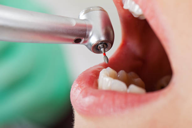 Best Emergency Dental Surgery in Emma, NC